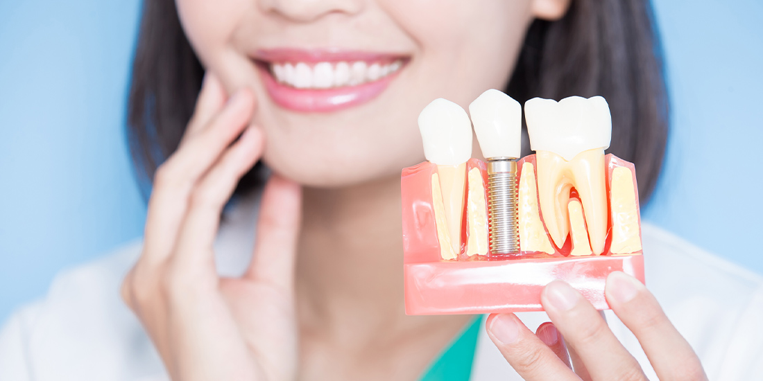 失われた歯を取り戻しいつも通りの生活へ