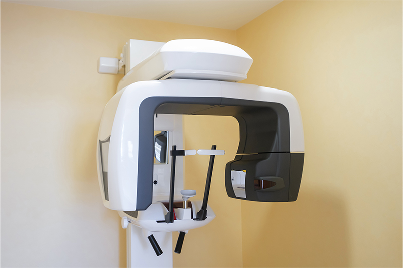 CT撮影による精密な診断